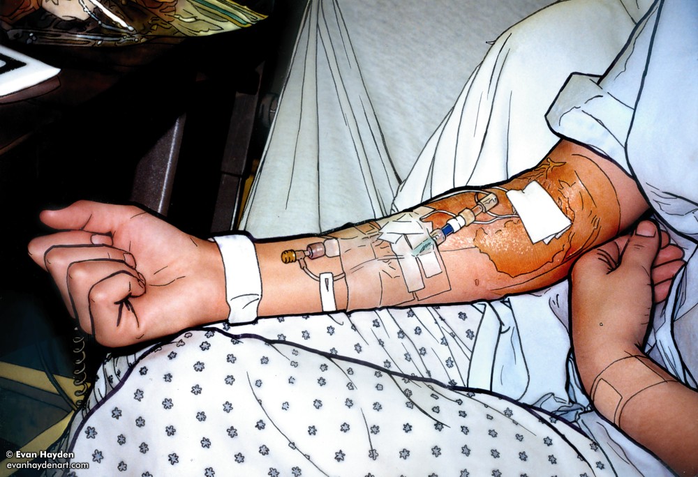 On the Mend